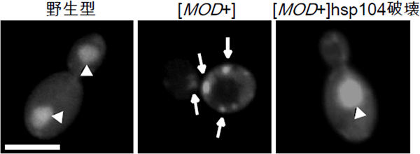 [MOD+]酵母内のMod5タンパク質の局在の画像