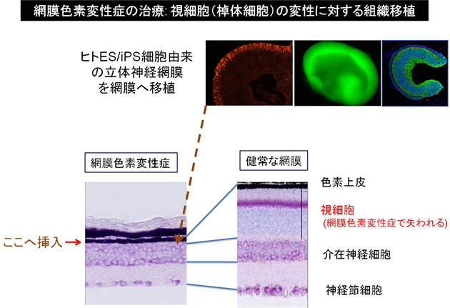 ヒト立体網膜組織を用いる次々世代再生医療の展望の図