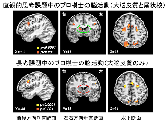 詰め将棋を解いているときのプロ棋士の脳活動の図