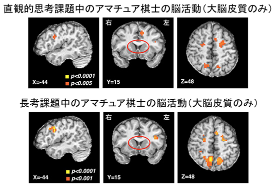 詰め将棋を解いているときのアマチュア棋士の脳活動の図