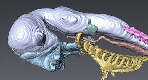 コンピューターを用いて組織標本から復元されたヌタウナギ胚頭部の画像の図