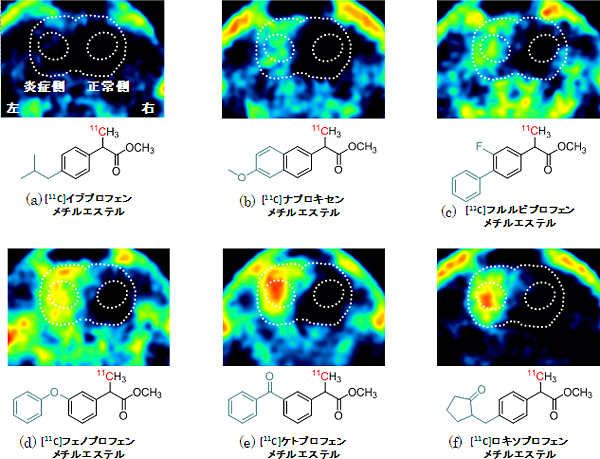  [11C]2-アリールプロピオン酸メチルエステルの評価の図