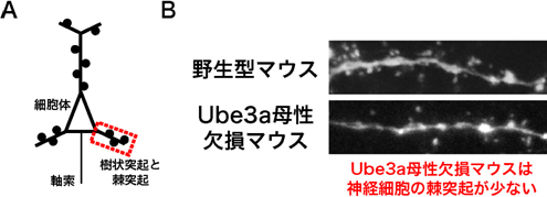Ube3a母性欠損マウスの神経細胞の棘突起の図