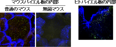 パイエル板内部に共生するAlcaligenes菌の図