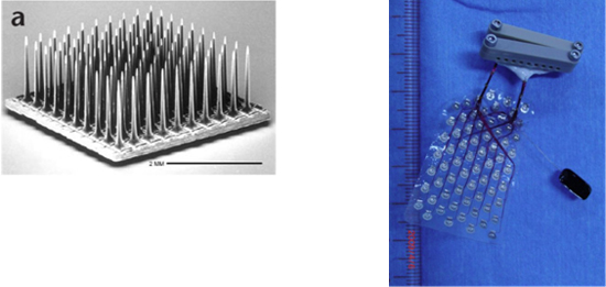 従来使ってきた剣山状電極（左）と今回開発した慢性留置型ECoG電極（右）の図