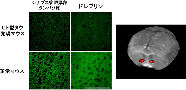 ヒト型タウ発現マウスで老齢期に見られる側坐核の構造異常と機能異常の図