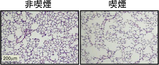 3カ月後の喫煙による肺胞構造の比較の図