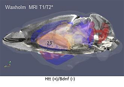 ウェブ上のマウス脳共通空間(WHS: Waxholm Space)でMRI画像に遺伝子発現解析を統合した図の画像