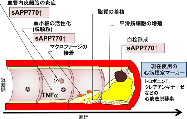 急性冠症候群の病理進行過程と切断型APP770の変動の図