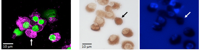 Figure showing the position of enucleated RBCs