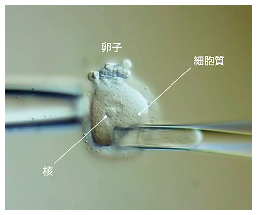 卵子の細胞質を減らす様子の図