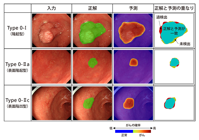 内視鏡専門医の診断範囲とAIによる診断範囲の比較の図