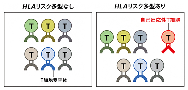 HLA遺伝子の個体差（多型）がT細胞受容体に影響を与えるの図