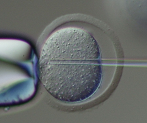 マウスの卵子に顕微授精をする様子の画像