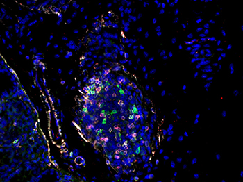 大腸ILC3の組織染色イメージの画像