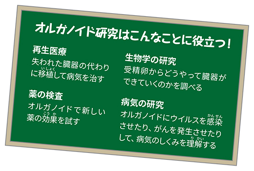 オルガノイド研究はこんなことに役立つ！再生医療、失われた臓器の代わりに移植して病気を治す。薬の検査、オルガノイドで新しい薬の効果を試す。生物学の研究、受精卵からどうやって臓器ができていくのかを調べる。病気の研究、オルガノイドにウイルスを感染させたり、がんを発生させたりして、病気のしくみを理解する