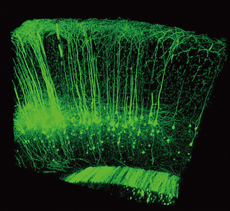 大脳皮質の神経細胞の図