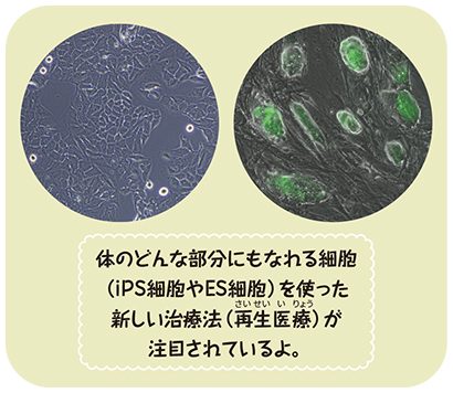 細胞の写真 体のどんな部分にもなれる細胞（iPS細胞やES細胞）を使った新しい治療法（再生医療）が注目されているよ