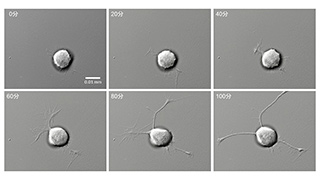 神経細胞が突起を伸ばす様子の図