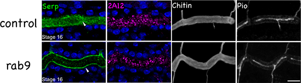 rab9遺伝子変異体で見られるキチン質修飾酵素の分布異常の図