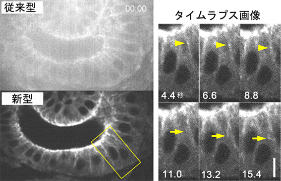 EB1-GFPを発現するショウジョウバエ胚のライブイメージング画像の図