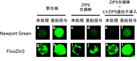 蛍光亜鉛プローブを用いた細胞内亜鉛濃度の評価の図