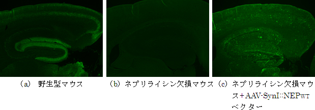 新規に開発したウイルスベクターをマウスの血管内に投与した後、脳内でのネプリライシの発現を観察した様子の画像