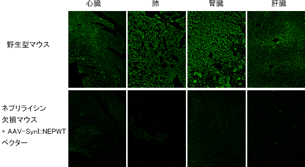 新規開発ベクター血管内投与後の末梢組織でのネプリライシンの発現の画像