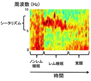 レム睡眠と海馬シータリズムの図