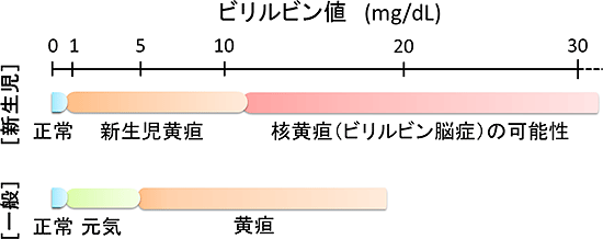 血清ビリルビン濃度（ビリルビン値）によって変わるヒトの健康状態の図