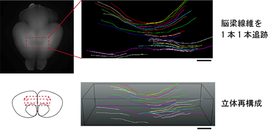 脳梁線維を1本1本の解像度で可視化・再構築の図