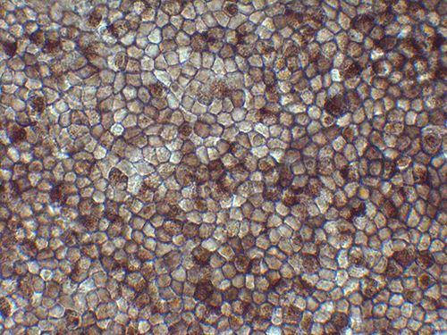 Photo of Retinal Pigment Epithelium (RPE) cells derived from human iPS cells 