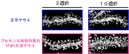 プルキンエ細胞のスパイン形成の観察結果の図
