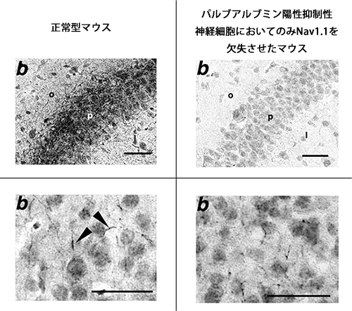 Nav1.1は、正常型マウス脳において、PV陽性抑制性神経細胞軸索に強く発現するの図