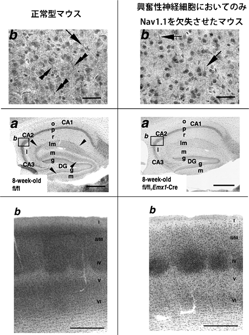 Nav1.1は、正常型マウス脳において、興奮性神経細胞の一部（内側嗅内皮質-海馬 投射細胞、一部の大脳皮質錐体細胞、視床-大脳皮質投射細胞）に発現しているの図