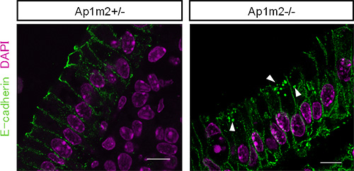 AP-1B欠損マウスの腸管上皮細胞におけるE−カドヘリンの局在異常の図