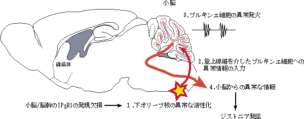 小脳/脳幹だけでIP3R1を欠損させたマウスにおけるジストニア発症メカニズムのモデルの図