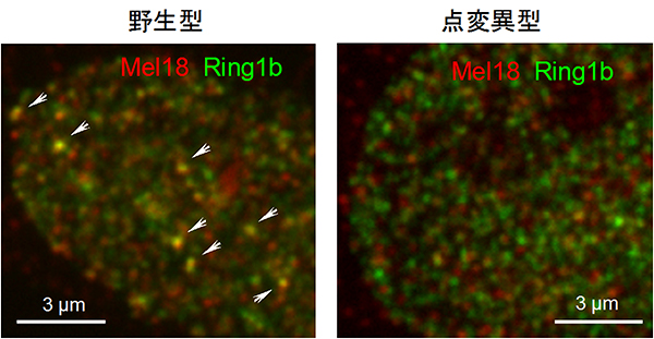 Phc2遺伝子点変異マウス由来の細胞でのポリコム構造体の消失の図