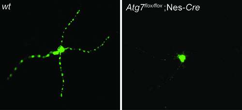 Photos showing that autophagy mediates A&beta; secretion 