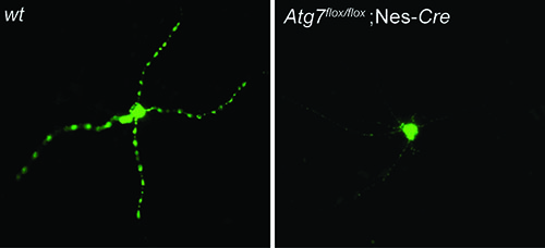 Photos showing that autophagy mediates Aβ secretion