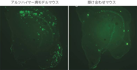 20ヶ月齢マウス脳内におけるアミロイド斑の蓄積の様子の画像