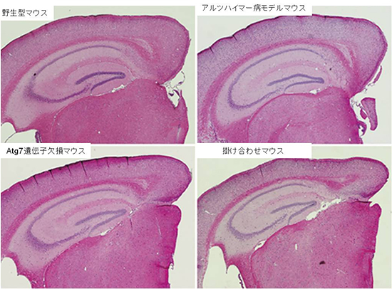15ヶ月齢のマウス脳内における神経細胞の様子の図