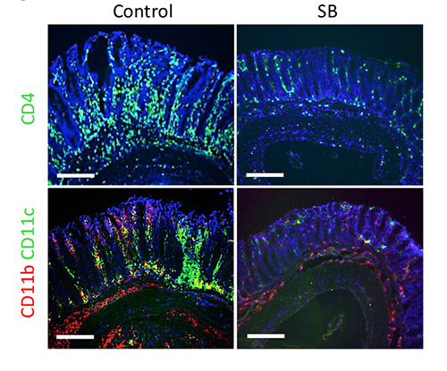 Photos showing infiltration of inflammatory cells in a mouse model for experimental colitis