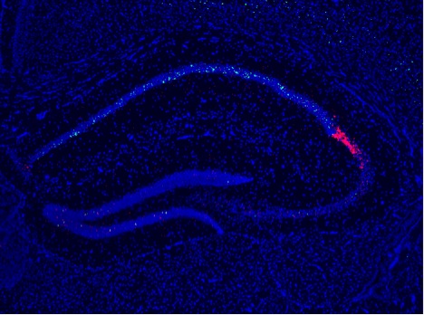 fluorescence imaging: hippocampus detects changes in context