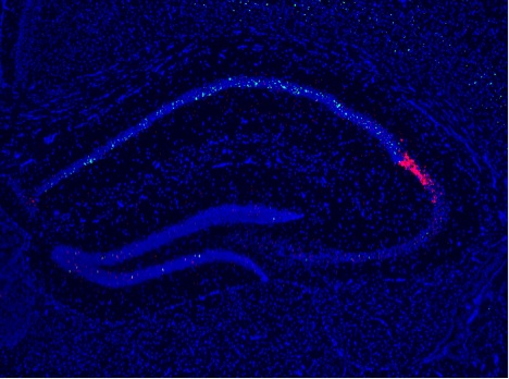 fluorescence imaging: hippocampus detects changes in context