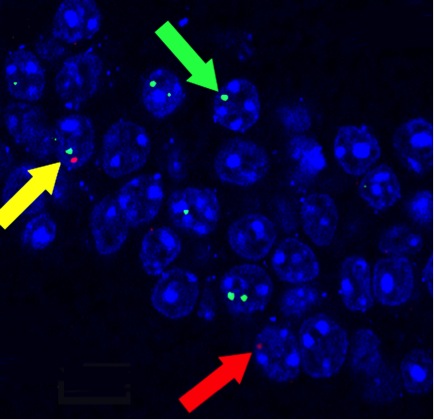 context detected in the hippocampus c2