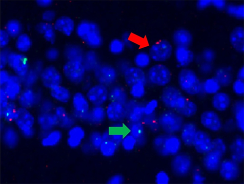 神経細胞の活動の様子の図