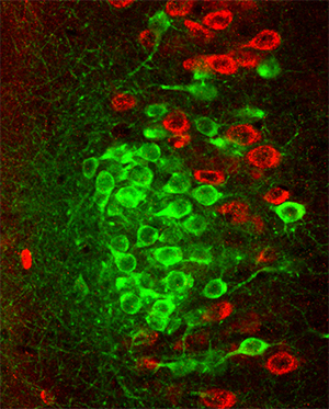 大脳嗅内皮質Ⅱ層におけるアイランドセル（緑色）とオーシャンセル（赤色）の画像