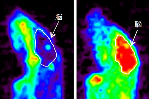 脂溶性キレーター「ジスルフィラム」併用による銅の脳内移行の促進の図