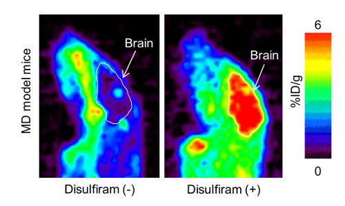 PET images showing copper accumulation in the brain